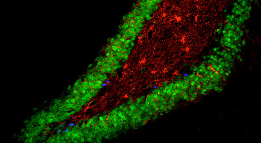 Adult Neurogenesis