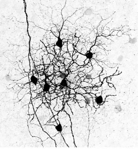 Retinal Circuits