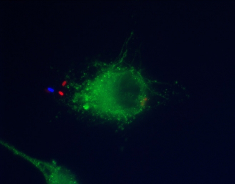 Electron micrograph of a Legionella pneumophila bacterium