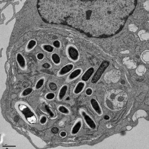 Salmonella typhimurium growing within a macrophage