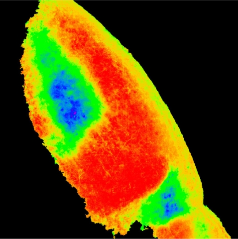 Segregation of ipsilateral versus contralateral retinal projections