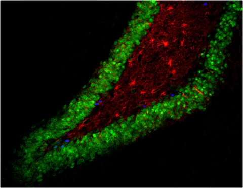 Adult Neurogenesis Adult Neurogenesis
