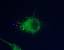 Electron micrograph of a Legionella pneumophila bacterium